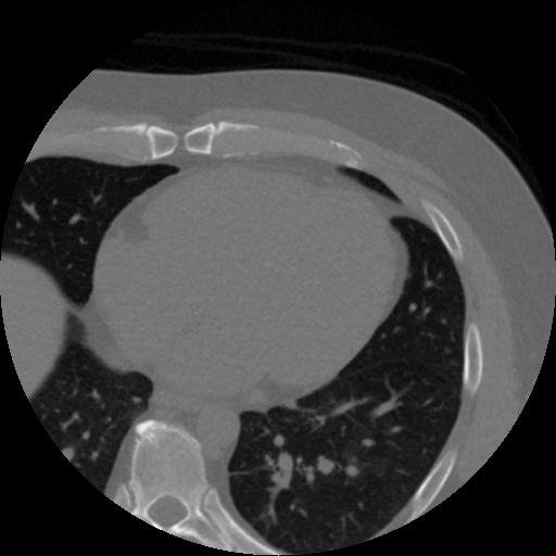 2023 CCS.0000DA16.EE22848C.jpg